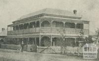 The Terminus Boarding House, Point Lonsdale, 1918-20